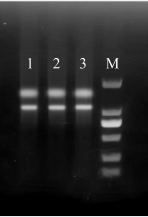 Simgen高多糖多酚植物總RNA試劑盒-DNase Ⅰ柱上消化試劑盒-提取閩楠葉片RNA電泳結果圖